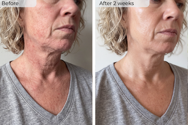 My skin stopped feeling tight